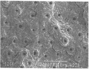 Image for - An Overview: Laser Applications in Dentistry
