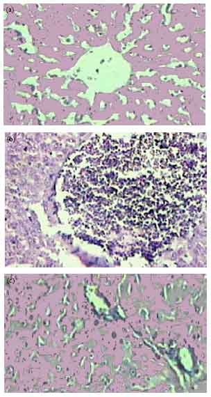 Image for - Anti-Diabetic Effects of Aqueous Ethanolic Extract of Hibiscus rosasinensis L. on Streptozotocin-Induced Diabetic Rats and the Possible Morphologic Changes in the Liver and Kidney