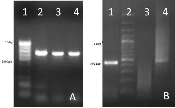 Image for - Moderation of Immunopathological Parameters by Pravastatin in Pasteurella multocida (Pm52) Induced Septicaemic Mice