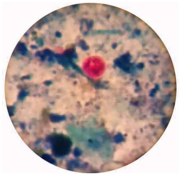 Image for - Efficacy and Promising Ameliorative Effect of Crocin Against Cryptosporidium parvum with Colon Ultrastructure Examination in Male Rats