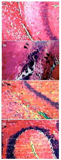 Image for - Ameliorating Effect of Ethanol Leaf Extract of Ficus hispida Linn. on Amyloid beta Aβ (25-35) Induced Cognitive Deficits and Oxidative Stress in Alzheimers Mice