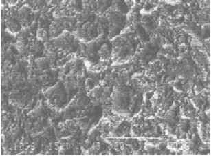 Image for - An Overview: Laser Applications in Dentistry