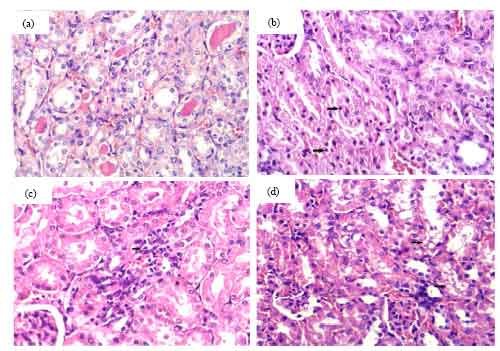 Image for - The Protective Effects of Nigella sativa Oil and Allium sativum Extract on Amikacin-induced Nephrotoxicity