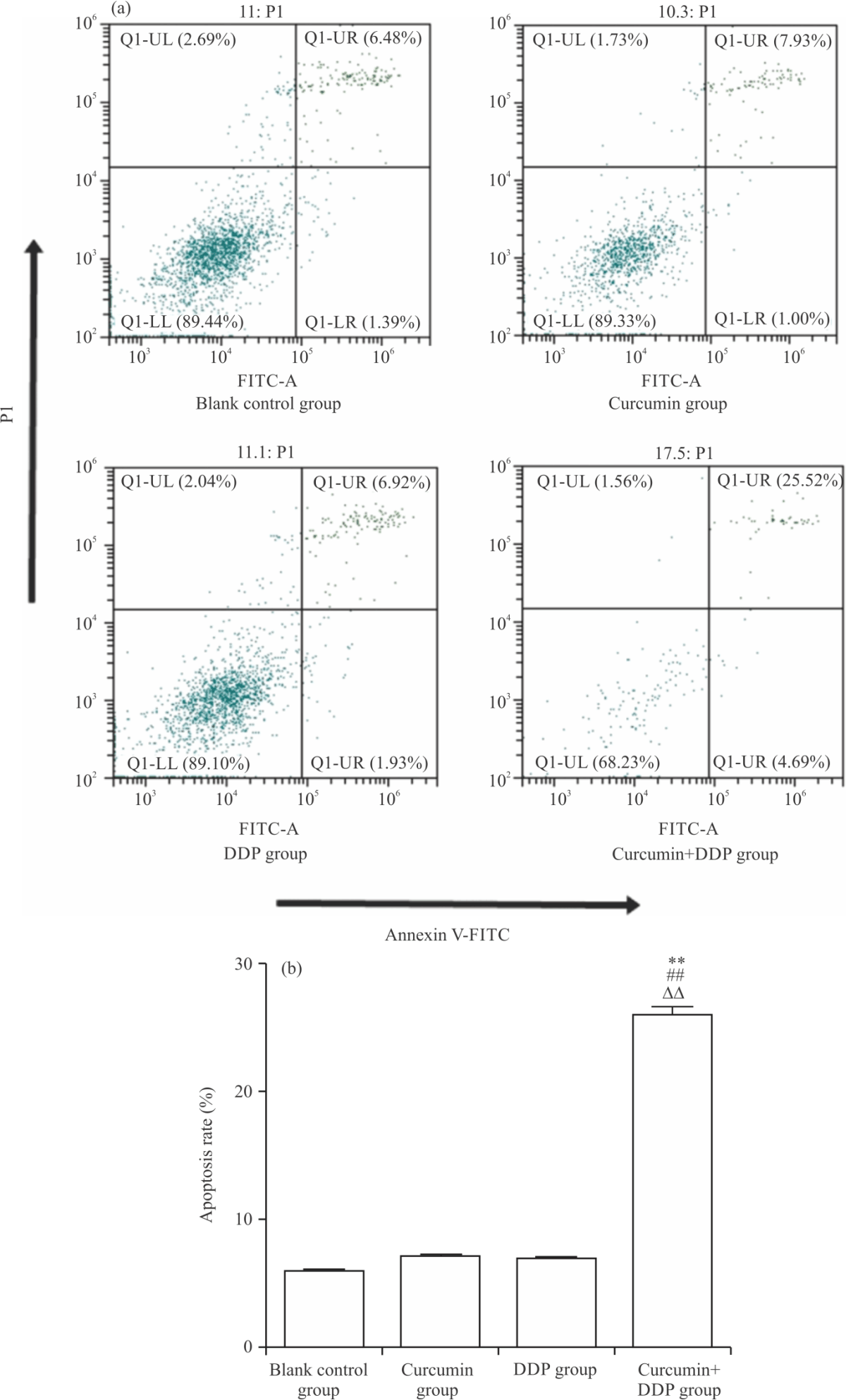 Image for - Curcumin Improving Drug Resistance of MDA-MB-231/DDP Tumor Treatment by Enhancing Autophagy