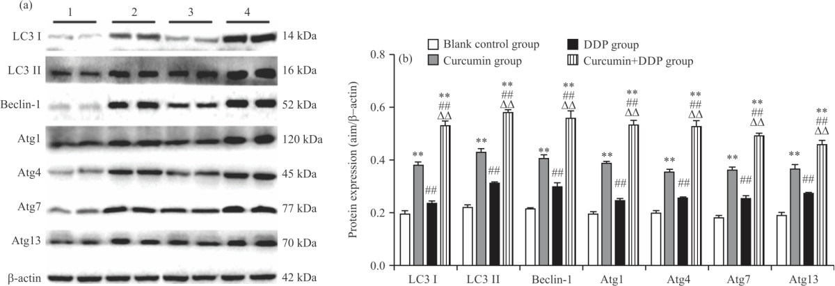 Image for - Curcumin Improving Drug Resistance of MDA-MB-231/DDP Tumor Treatment by Enhancing Autophagy