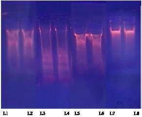 Image for - Evaluation of the Chemoprotective Role of N-Acetylcysteine on Cisplatin-Induced Nephrotoxicity: New Aspect of an Old Drug