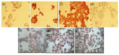 Determination of the Expression of COX II and Aromatase Protein in ...
