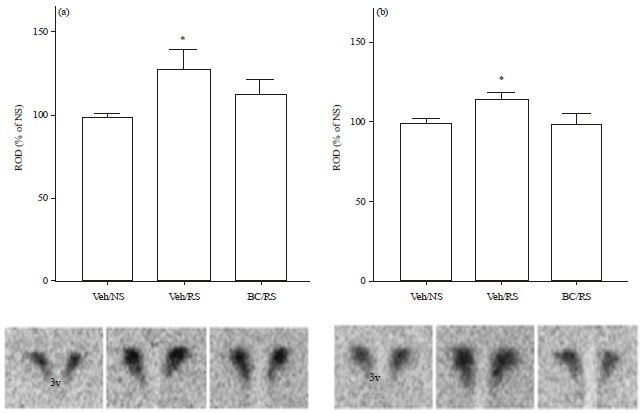Image for - Bicuculline Ameliorated Chronic, but not Acute, Stress-Induced Feeding Suppression