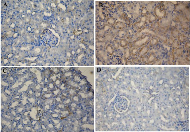 Image for - Evaluation of the Chemoprotective Role of N-Acetylcysteine on Cisplatin-Induced Nephrotoxicity: New Aspect of an Old Drug