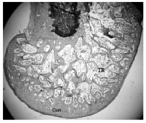 Image for - Methanol Extract of the Fruits of Morinda citrifolia Linn., Restores Bone Loss in Ovariectomized Rats