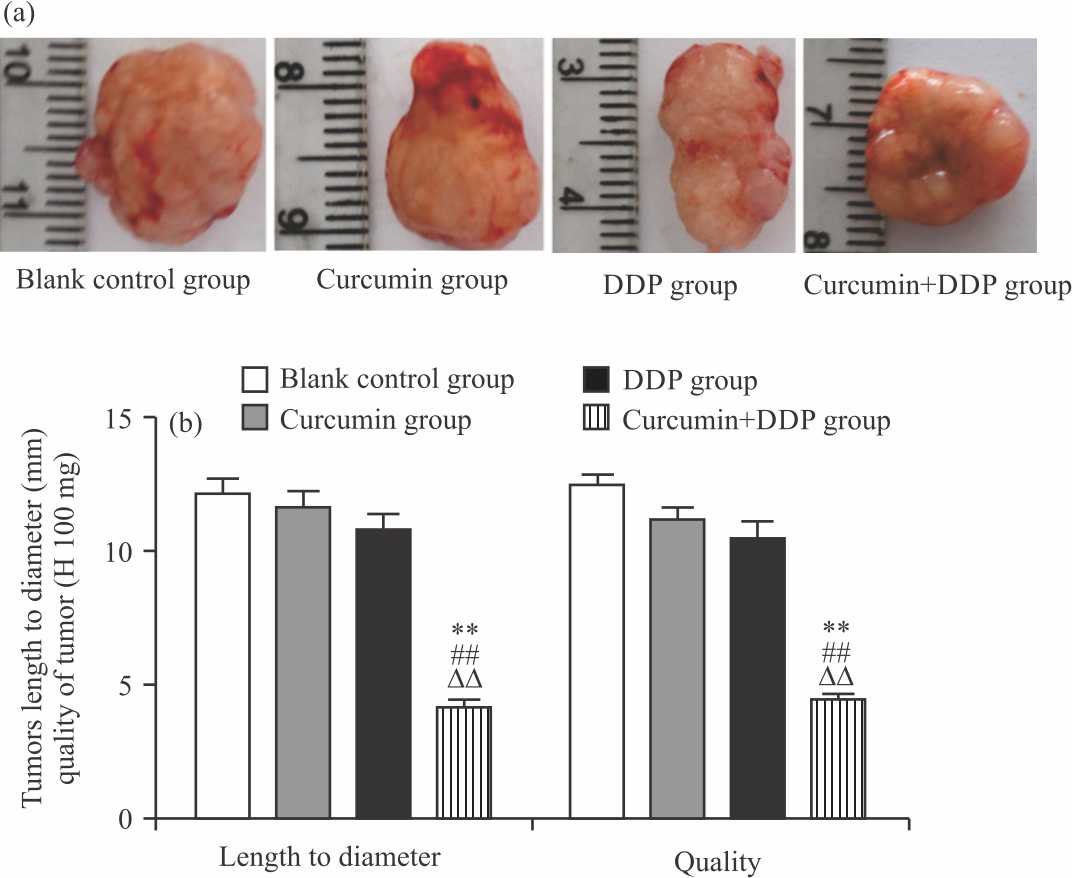 Image for - Curcumin Improving Drug Resistance of MDA-MB-231/DDP Tumor Treatment by Enhancing Autophagy