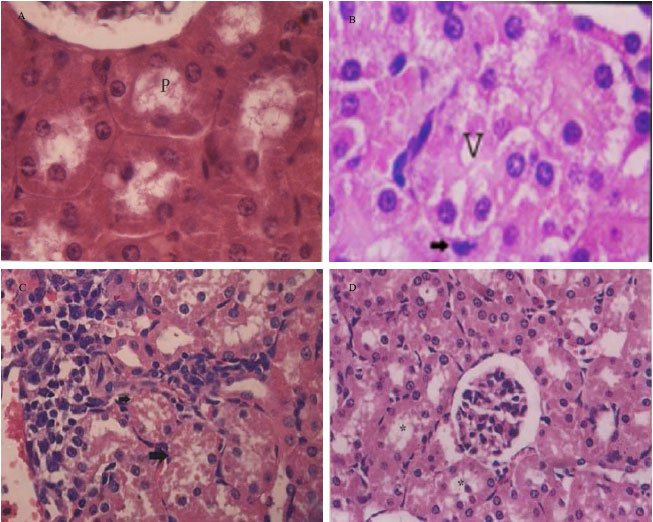 Image for - Evaluation of the Chemoprotective Role of N-Acetylcysteine on Cisplatin-Induced Nephrotoxicity: New Aspect of an Old Drug