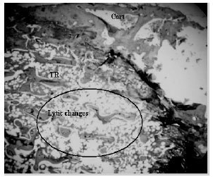 Image for - Methanol Extract of the Fruits of Morinda citrifolia Linn., Restores Bone Loss in Ovariectomized Rats
