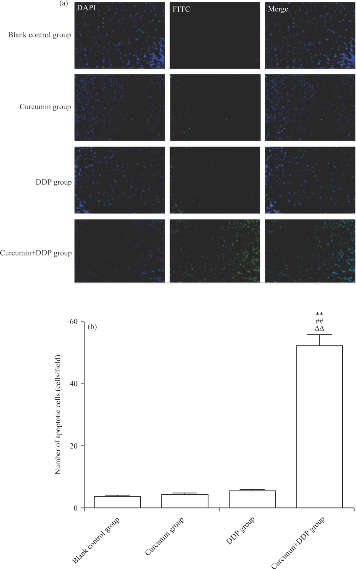 Image for - Curcumin Improving Drug Resistance of MDA-MB-231/DDP Tumor Treatment by Enhancing Autophagy