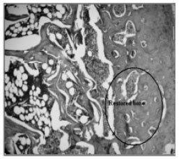 Image for - Methanol Extract of the Fruits of Morinda citrifolia Linn., Restores Bone Loss in Ovariectomized Rats