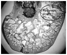 Image for - Methanol Extract of the Fruits of Morinda citrifolia Linn., Restores Bone Loss in Ovariectomized Rats
