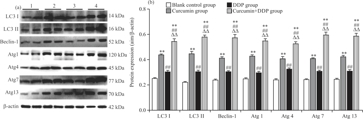 Image for - Curcumin Improving Drug Resistance of MDA-MB-231/DDP Tumor Treatment by Enhancing Autophagy