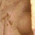 photo detail